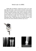 Referāts 'Rotējošās eņģes ceļa endoprotēze', 5.