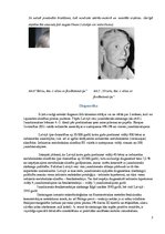 Konspekts 'Fenilketonūrija', 7.