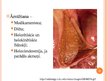 Prezentācija 'Žultspūšļa un žultsceļu ķirurģiskās slimības', 19.