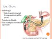 Prezentācija 'Žultspūšļa un žultsceļu ķirurģiskās slimības', 31.