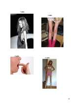 Referāts 'Anoreksija un bulīmija', 17.