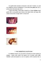 Referāts 'Smēķēšanas kaitīgā ietekme', 12.