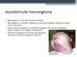 Prezentācija 'Asinsrites sistēmas slimības', 36.