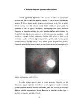 Referāts 'Kokeina sindroms', 13.