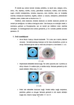 Konspekts 'Iridodiagnostika', 5.