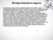 Prezentācija 'Rentgenstarojums', 5.