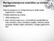 Prezentācija 'Rentgenstarojums', 11.