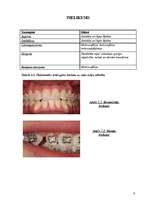 Referāts 'Ortodontija', 9.
