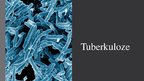 Prezentācija 'Tuberkuloze', 1.