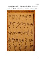 Referāts 'Zīmju valoda. Nedzirdība un sabiedrība', 8.