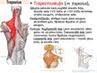 Prezentācija 'Muguras muskuļi', 4.