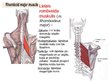 Prezentācija 'Muguras muskuļi', 6.