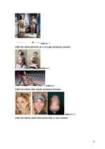 Referāts 'Anoreksiju veicinošie faktori pusaudžu vidū', 41.