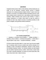 Referāts 'Preiļu notekūdeņu attīrīšanas iekārtu energoefektivitātes paaugstināšana', 23.