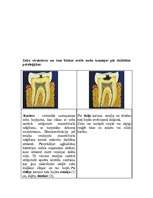 Referāts 'Veselīgs dzīvesveids', 26.