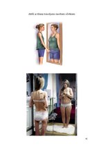 Referāts 'Ēšanas traucējumi', 41.