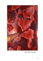 Referāts 'Aborts, aborta veidi, neauglība, aborta sekas', 25.