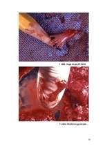 Referāts 'Aborts, aborta veidi, neauglība, aborta sekas', 28.