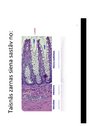 Prezentācija 'Resnās zarnas anatomija un histoloģija', 12.