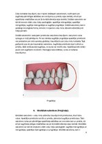 Referāts 'Patoloģiskais sakodiens, tā veidi un raksturojums', 8.
