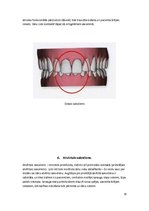 Referāts 'Patoloģiskais sakodiens, tā veidi un raksturojums', 10.