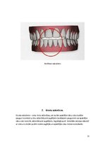 Referāts 'Patoloģiskais sakodiens, tā veidi un raksturojums', 11.