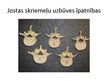 Prezentācija 'Mugurkauls', 23.