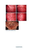 Referāts 'Cistīts', 4.