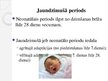 Prezentācija 'Jaundzimušā attīstības raksturojums, aprūpe, vecāku izglītošana, saskarsme', 3.