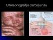 Prezentācija 'Ultrasonogrāfija', 3.