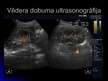 Prezentācija 'Ultrasonogrāfija', 7.
