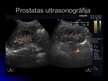 Prezentācija 'Ultrasonogrāfija', 8.