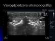 Prezentācija 'Ultrasonogrāfija', 9.