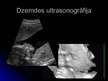 Prezentācija 'Ultrasonogrāfija', 10.