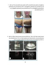 Referāts 'Invazīvās karboksiterapijas pielietošanas efektivitāte ķermeņa estētisko problēm', 20.