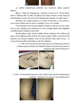 Referāts 'Invazīvās karboksiterapijas pielietošanas efektivitāte ķermeņa estētisko problēm', 24.