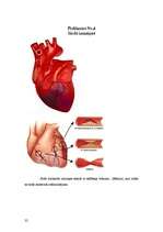 Referāts 'Koronārās sirds slimības un to riska faktori', 32.