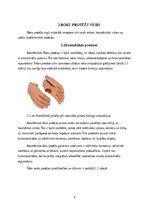 Referāts 'Roku protēzes', 10.