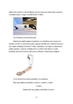 Referāts 'Roku protēzes', 13.