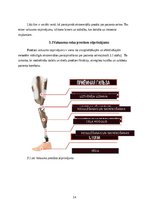 Referāts 'Roku protēzes', 15.