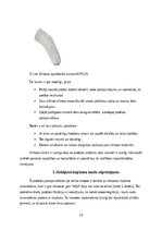 Referāts 'Roku protēzes', 17.