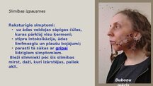 Prezentācija 'Infekcijas slimības: Mēris (Yersinia pestis)', 7.