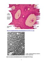 Prezentācija 'Kļūdu labojums patoloģijā', 5.