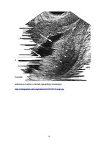 Prezentācija 'Kļūdu labojums patoloģijā', 6.