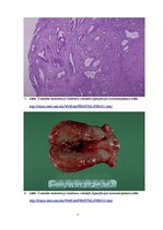 Prezentācija 'Kļūdu labojums patoloģijā', 7.