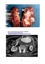 Prezentācija 'Kļūdu labojums patoloģijā', 11.