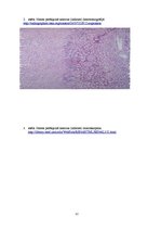 Prezentācija 'Kļūdu labojums patoloģijā', 12.