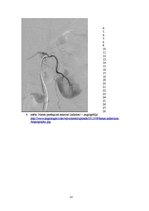 Prezentācija 'Kļūdu labojums patoloģijā', 13.