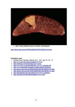 Prezentācija 'Kļūdu labojums patoloģijā', 14.