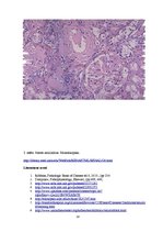 Prezentācija 'Kļūdu labojums patoloģijā', 18.